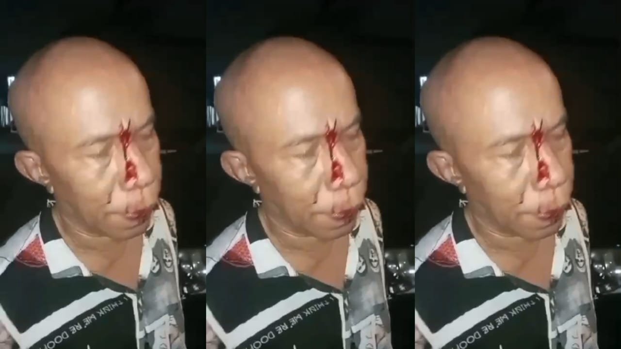 Dugaan Suap di Unit 5 Resmob Polres Jaksel, Korban Pengeroyokan Tak Dapat Keadilan